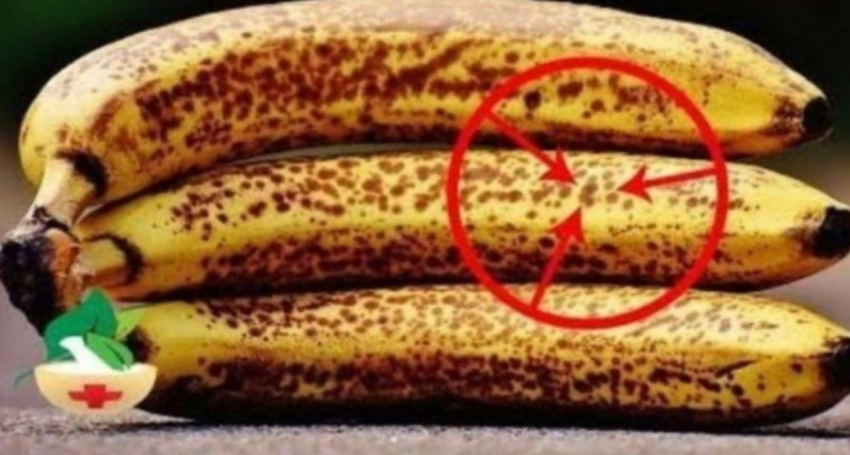 cfare-ndodh-me-trupin-kur-konsumojme-banane-te-pjekura-me-pika-te-zeza