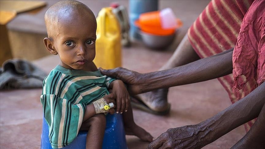 unicef:-mungesa-e-ushqimit-ne-somali-le-500-mije-femije-ne-rrezik-te-vdekjes