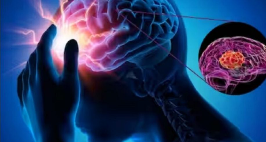 a-mund-te-coje-migrena-kronike-ne-demtim-afatgjate-te-trurit?