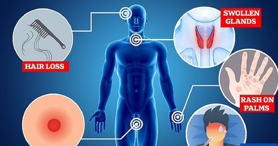 pese-shenja-paralajmeruese-te-sifilizit,-rriten-rastet-e-kesaj-semundje