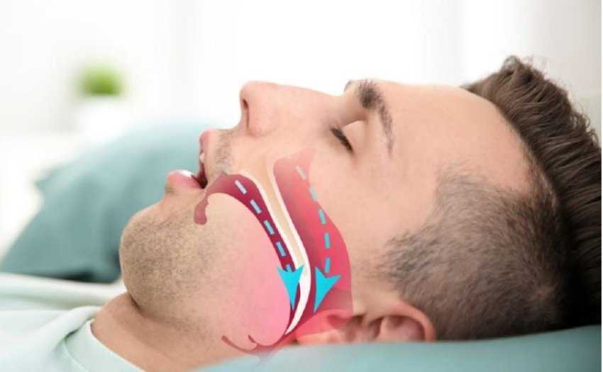 efektet-negative-ne-shendet-qe-shkakton-frymemarrja-me-ane-te-gojes