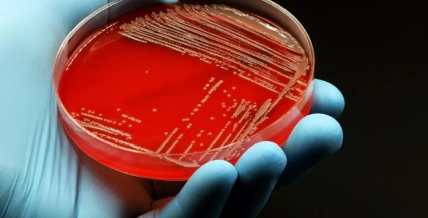 a-i-fshijne-vertet-antibiotiket-bakteret-e-zorreve?