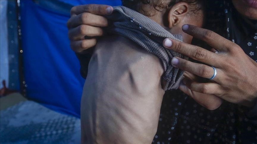 raporti-i-okb-se-paralajmeron-per-thellimin-e-krizes-se-urise-ne-16-vatra-globale