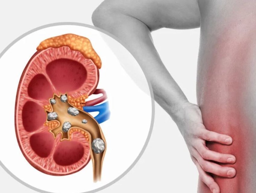 shkencetaret-krijojne-mikrobe-te-zorreve-te-modifikuara-gjenetikisht-qe-zberthejne-guret-ne-veshka