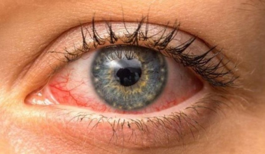 tharja-e-syve-nga-telefoni,-kujdesi-qe-duhet-te-tregoni