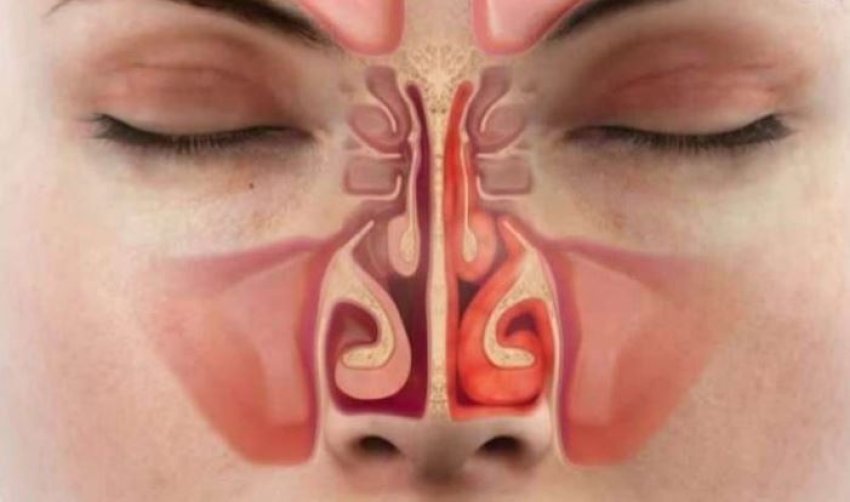 si-lidhet-temperatura-e-hundes-me-stresin