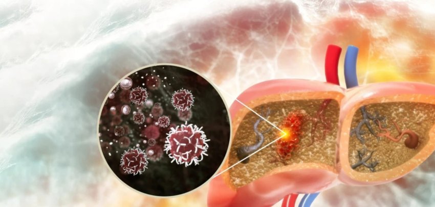 dhimbje-te-forta-dhe-rrezik-frakturash:-si-perhapet-kanceri-i-melcise-ne-kocka