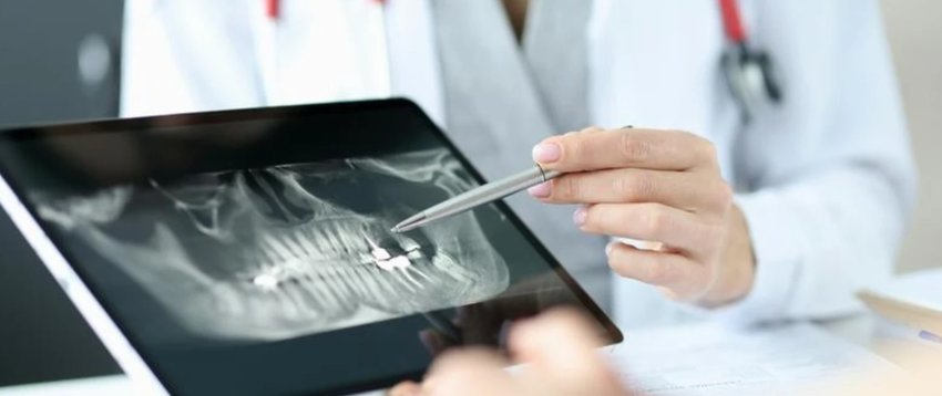 humbja-e-shpejte-e-dhembeve-mund-te-jete-shenje-e-rrezikut-me-te-madh-per-vdekje