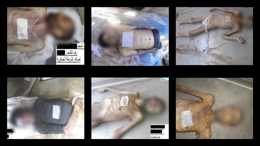 zbulohen-mbi-70-mije-foto-te-reja-te-krimeve-te-luftes-te-kryera-nga-regjimi-i-asadit