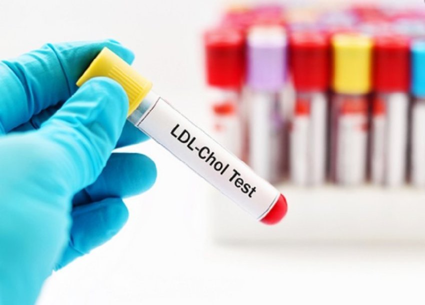 zbulohet-ilaci-i-ri-i-cili-ul-ndjeshem-ldl-(kolesterolin-e-keq)