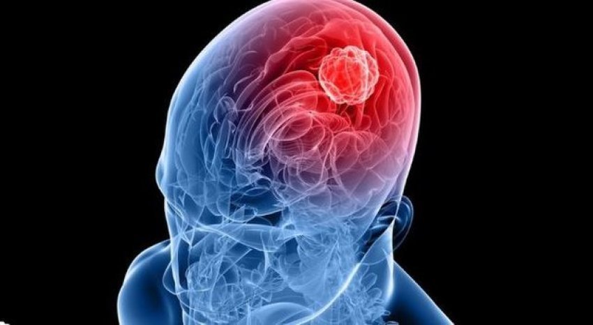 truri-“fiket”-papritur-para-gjumit