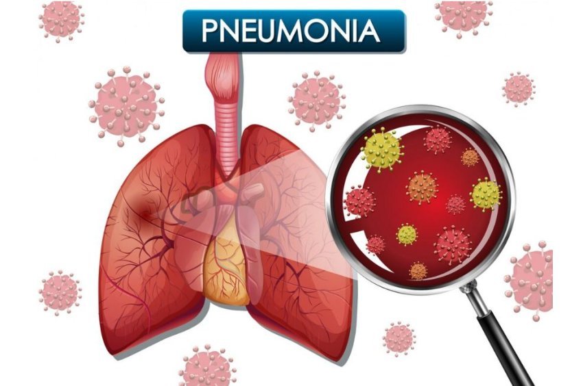 si-te-mbroheni-nga-pneumonia-gjate-dimrit?