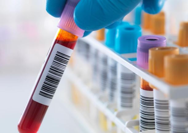 ne-vitin-2025-rreth-2-mije-raste-te-reja-me-kancer,-rritje-te-moshat-30–50-vjec