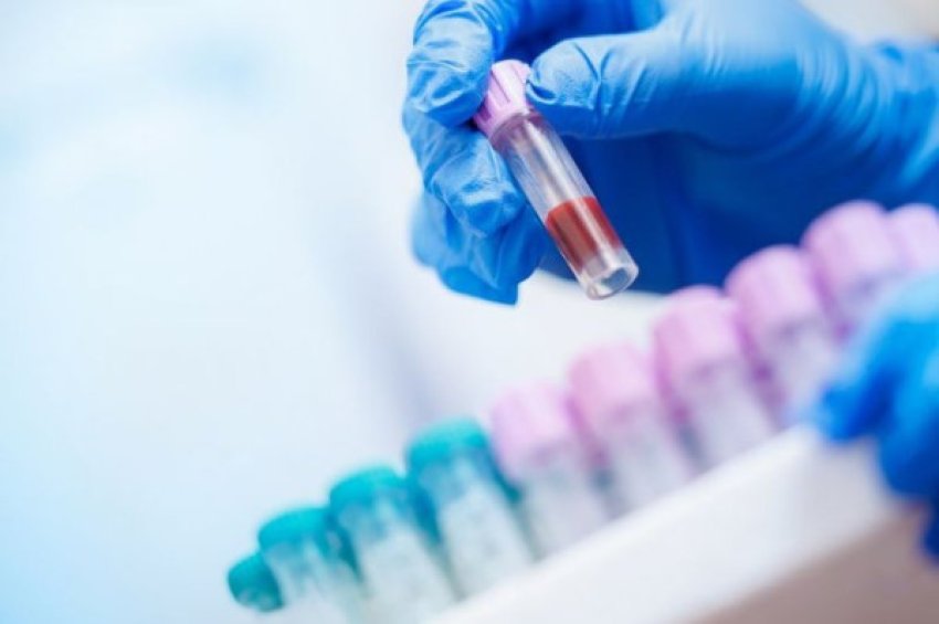 testi-i-thjeshte-i-gjakut-parashikon-rrezikun-nga-semundja-e-trasheguar-e-zemres