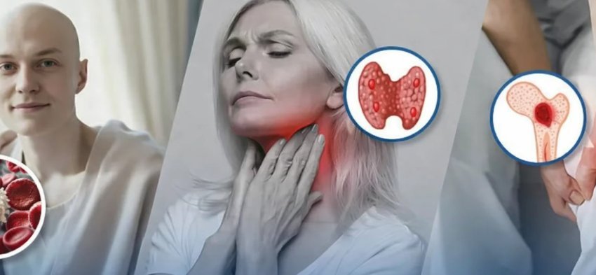 limfoma-dhe-leukemia-jane-forma-te-renda-te-kancerit:-si-shfaqen-dhe-cilet-jane-faktoret-e-rrezikut-–-disa-prej-tyre-mund-te-shmangen