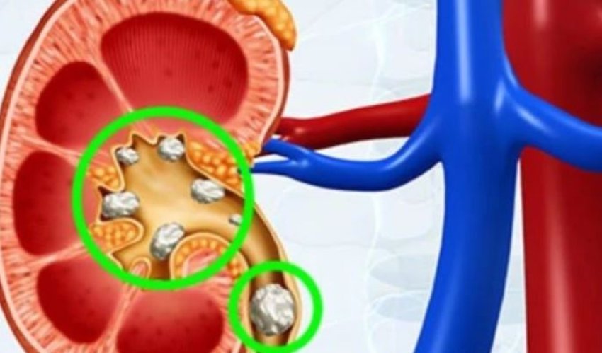 shenjat-qe-tregojne-pranine-e-gureve-ne-veshka