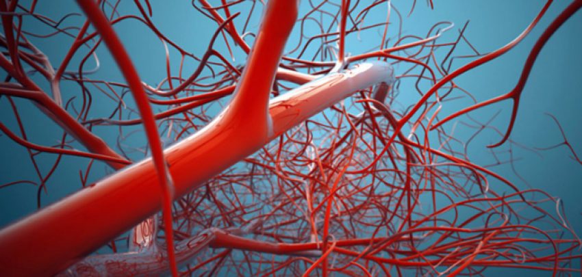 metoda-ideale-per-te-larguar-yndyren-ne-gjak