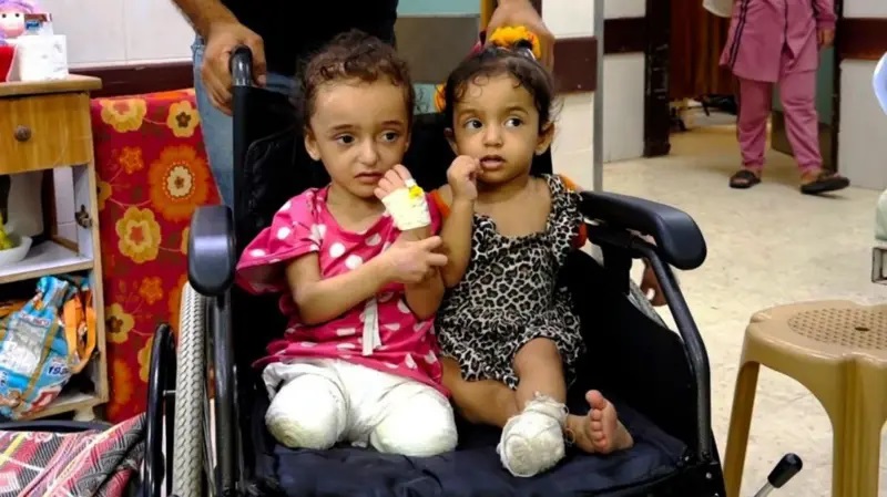 program-humanitar-ne-kili-per-proteza-per-femijet-e-gjymtuar-ne-gaza