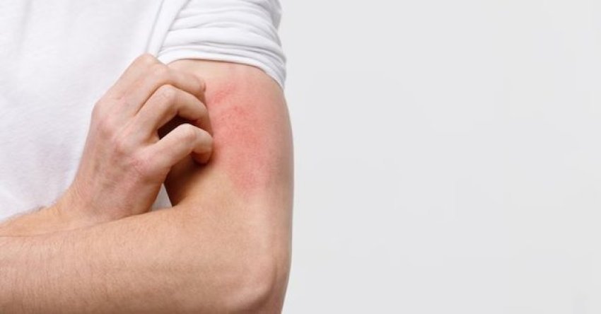 dermatologet:-kruajtja-e-trupit-mund-te-fshehe-semundje-serioze