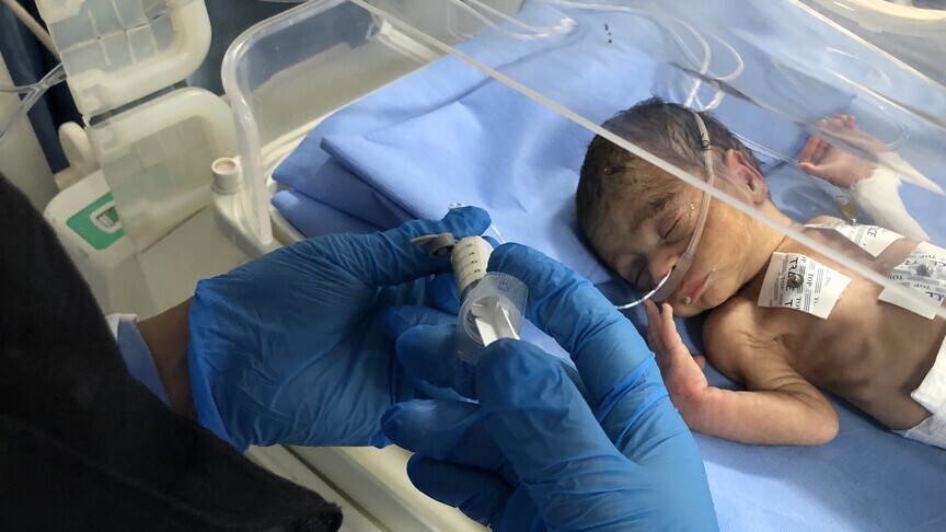 bllokada-izraelite-kercenon-mbylljen-e-te-vetmit-impiant-oksigjeni-ne-gazen-veriore