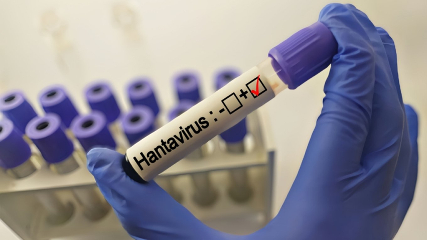 hantavirusi/-sa-lloje-ekzistojne,-si-transmetohet-dhe-pse-ekspertet-nuk-jane-te-shqetesuar