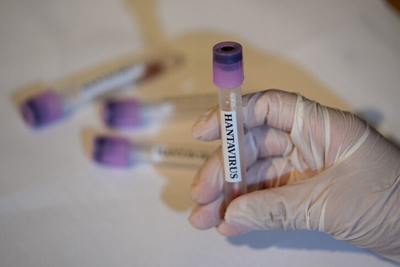 franca:-te-gjithe-kontaktet-me-hantavirusin-jane-asimptomatike,-4-femije-rezultojne-negative