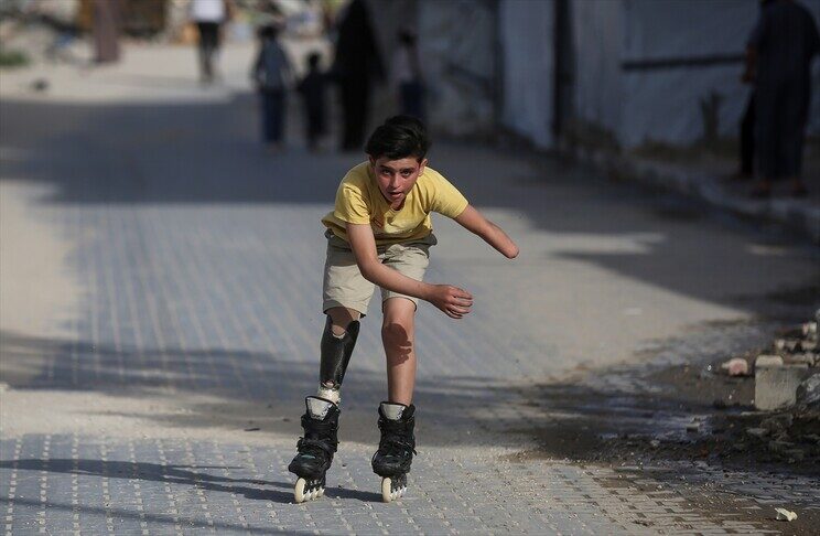 djaloshi-nga-gaza-qe-humbi-gjymtyret-ne-nje-sulm-izraelit-vazhdon-jeten-fale-pasionit-per-patinazhin