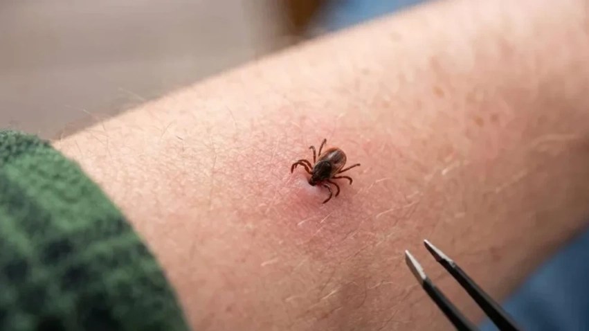 rriqra-nuk-transmeton-vetem-semundjen-lyme:-mund-te-shkaktoje-alergji-te-rrezikshme-ndaj-mishit