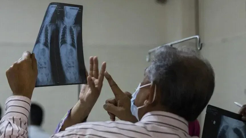 vdekjet-nga-fruthi-ne-bangladesh-arrijne-ne-1.030-pas-vdekjes-se-tete-femijeve-te-tjere