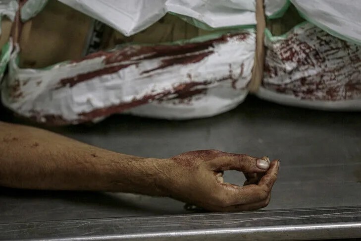 sulmet-izraelite-ne-gaza,-8-palestineze-te-vrare-dhe-dhjetera-te-plagosur